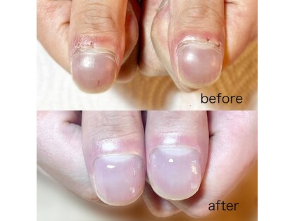 シェイプネイル(Shape Nail)の写真