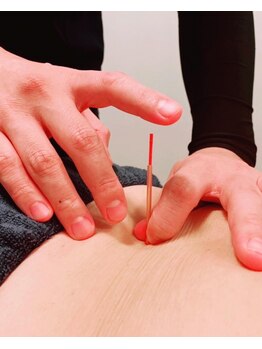 鍼灸院接骨院テトテ(tetote)/施術風景