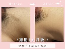 シエスタビューティラボの雰囲気（初回3,300円～うなじや各部位、VIO脱毛など。夏までにスッキリ！）