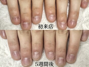 グラシナ 鳥丸店/癖を防いでしっかり伸ばす