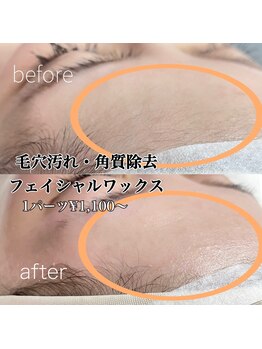 シリーラッシュ 自由が丘南口/フェイシャルワックス