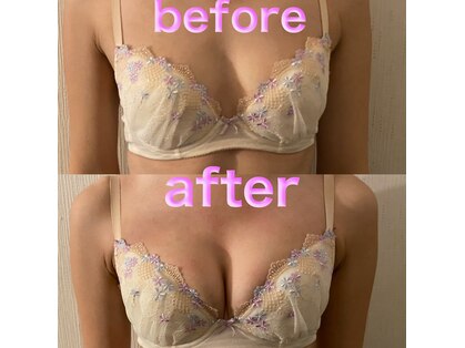 カール(curl)の写真