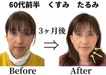 ラ キュート(LA-9TE)