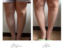 整友接骨院の雰囲気（ビフォーアフター）