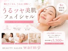 ウォーム(warm)