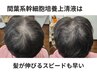 これでダメなら諦めて★本格育毛促進60分55000円