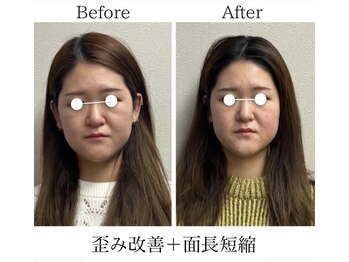 ラボーテヴェリテ(La Beaute Verite)/【お客様施術例】