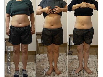 しあわせ腸研究所/腸もみbefore & after