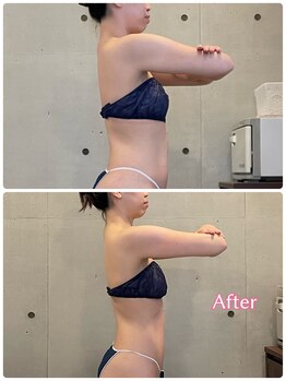 エクセレントビューティーサロン 艶(EN)/ブライダル１回