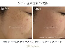 シュシュ 岸和田(chouchou)の雰囲気（-ハーブピーリング/肌質改善専門スキンケア-）