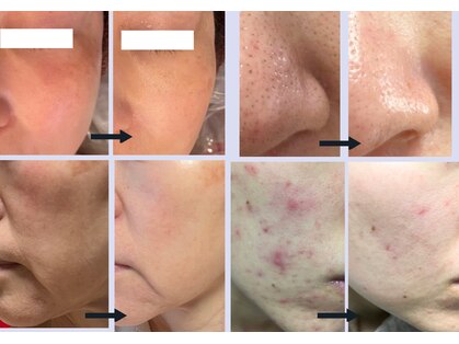 ジェニックサロン グランギンザ 水戸(GENIC SALON GRAND GINZA)の写真