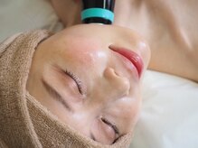 リフト 柏(Lift)の雰囲気（丸顔・脂肪多めさんに大人気＊マイクロウェーブリフト【柏】）