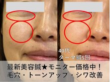皇漢堂鍼灸療院の雰囲気（毛穴が気になる方は★最新美容鍼【ダーマ鍼】モニター特別価格）