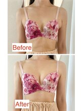 シエスタ(SIESTA)/卒乳後のバストUPの効果ピカイチ