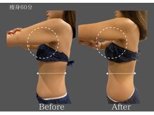 クレビア 麻布十番(CREBIA)/【痩身/代謝促進】