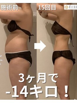 ブレス 天童店(BLESS)/セルゼロ全身月3回×20回　