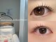 ミニョン(Mignon)の写真