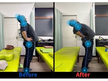 整骨院こころ 曙院/可動域の変化