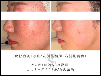 韓国肌管理室 ソア(soa)/【1:1オーダメイド肌施術】