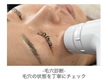 ステラ(Stella)/専用カメラで毛穴トラブル分析