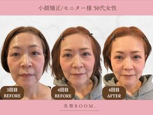 美整ルーム 横浜店(美整ROOM)の雰囲気（満足度の高い小顔矯正をご提供☆美整小顔を作り上げます！/横浜）