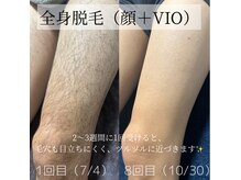 カナウ(KANAU)の雰囲気(口コミ70件の高評価サロン◎1番人気の全身脱毛は初回6,900円!!)