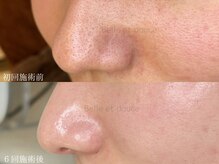 ベルエドゥース(Belle et Douce)の雰囲気（当店の毛穴ケアは仕上がりが違います！）