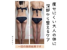 ピースツリー(PEACE TREE)