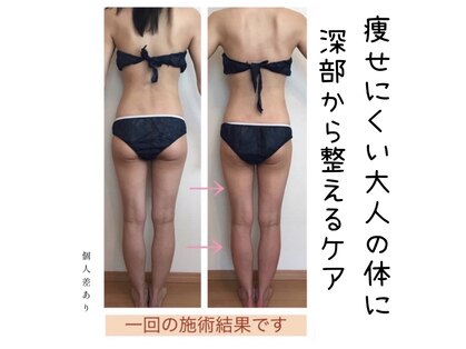 ピースツリー(PEACE TREE)の写真