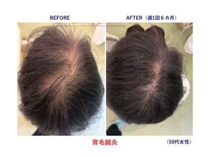 かつらはりきゅう 小児しんの写真