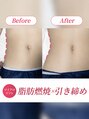 リフト 錦糸町(Lift) 1回でお肌 白玉肌★