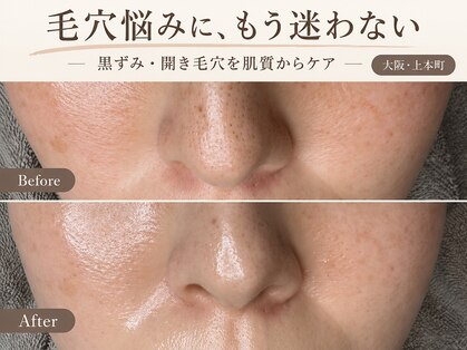 ヘリ(HERI.)の写真