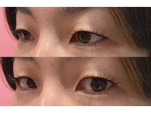 ラス 方南町駅前店(LATH)/3月☆まつげ