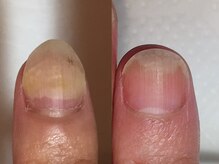 サロン ルーシュ(salon ruche)/育成ネイル