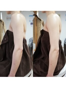 RiとBiのたまご/上半身マッサージ
