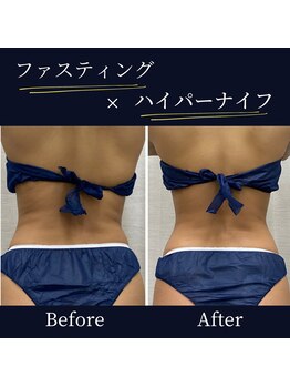 ハリルル 併設 GLケンタ鍼灸整骨院(HARILULU)/ハイパーナイフ