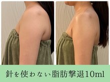 ソルニスデュオ(Solnis.-duo-)/痩身/酵素浴/毛穴/よもぎ蒸し