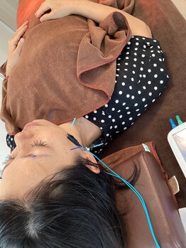 ハリファ鍼灸院 横浜関内院(HariFa鍼灸院)/美容施術