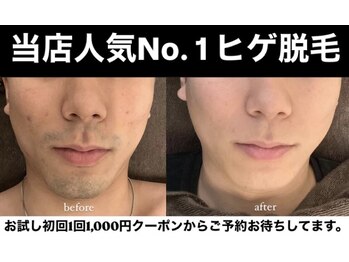 エルチェーロ(El Chulo)