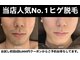 エルチェーロ(El Chulo)の写真