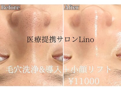 リノ(linO)の写真