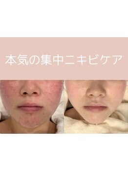 お肌をきれいにしたい