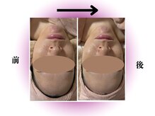 カリアンヌ/温活リンパフェイシャル/小顔