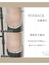 カピリナ(Kapilina)/ WINBACK季節別お悩み