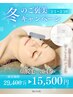【2/1】~【2/15まで】顔脱毛3回券