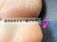 ナンバーアンドスリーサン(No&33)の雰囲気（足のかかとケアお済みですか？）