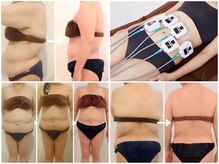 エステティックサロン エポック(epoque)の雰囲気（今ある脂肪は最新マシンで燃焼！経絡整体で脂肪を燃やせる体へ）