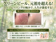 ナンバーナイン(N°9)