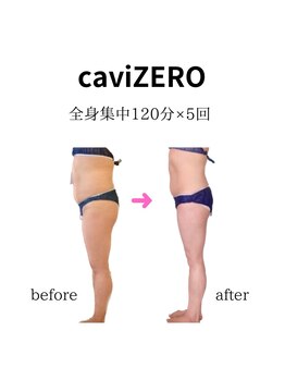 ルプリュシュ ルフレ(Le plus reflet)/キャビゼロこうか!全身