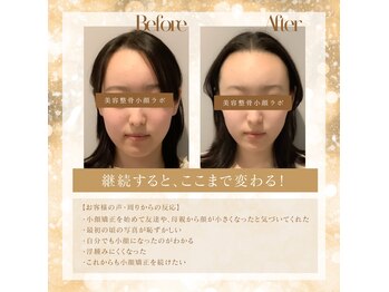 美容整骨小顔ラボ/ビフォーアフター